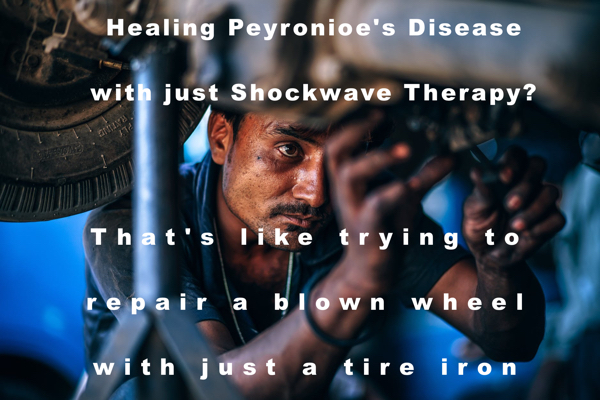 low-intensity-shockwave-ed-peyronies